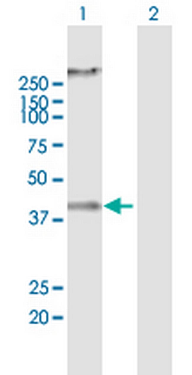 RNF133 Antibody in Western Blot (WB)