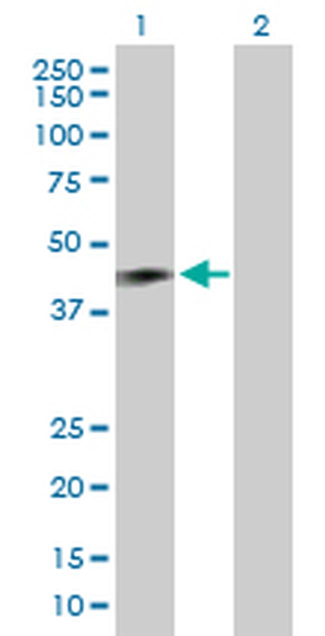 RNF133 Antibody in Western Blot (WB)