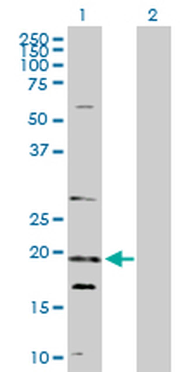 NUDT10 Antibody in Western Blot (WB)