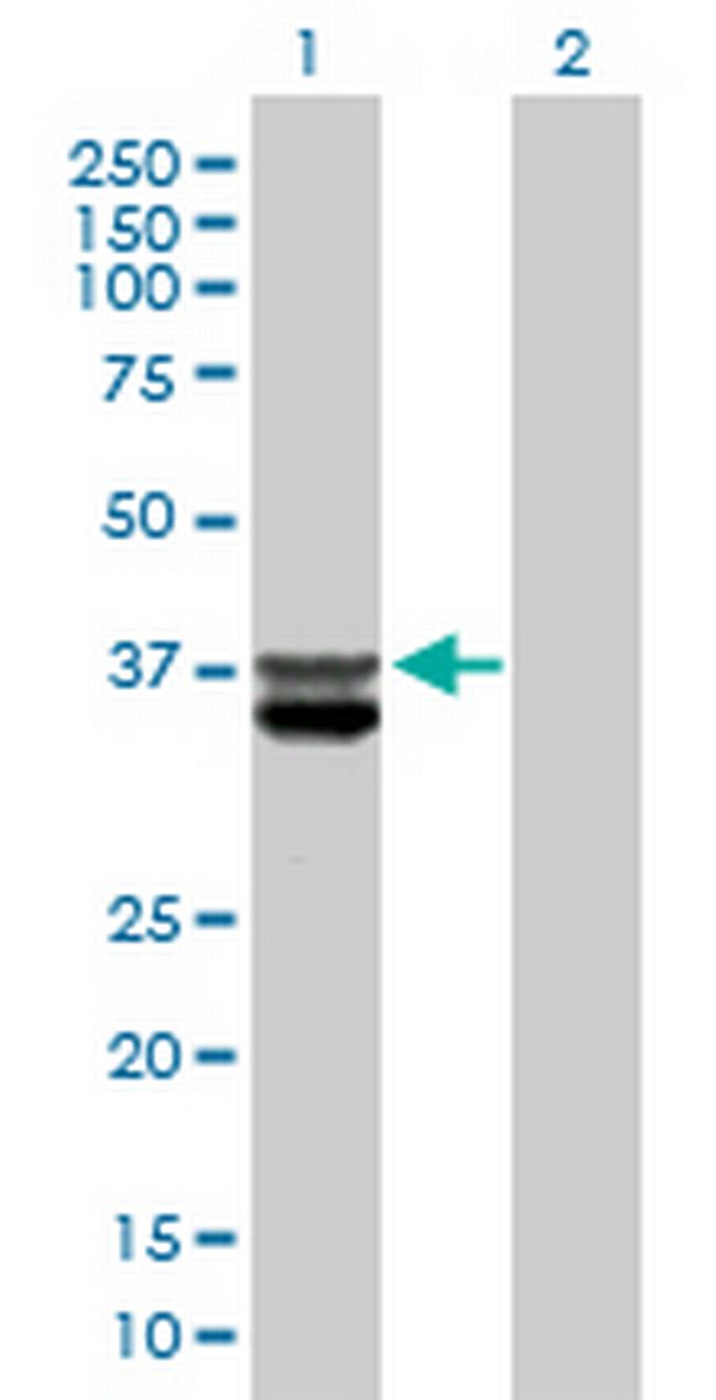 CLYBL Antibody in Western Blot (WB)