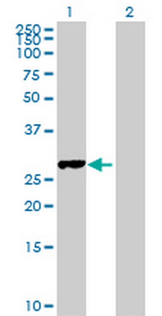 FAM9B Antibody in Western Blot (WB)
