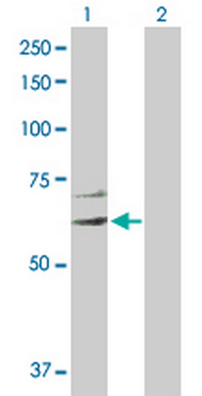 EIF2C3 Antibody in Western Blot (WB)