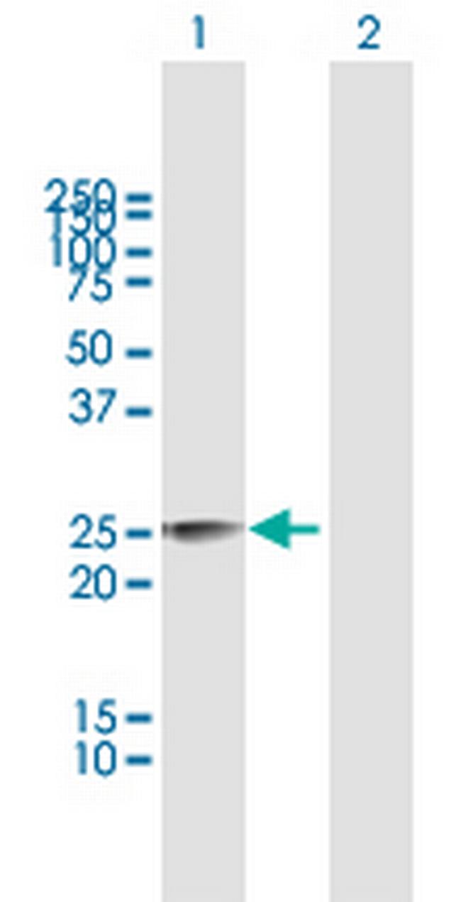 MPZL3 Antibody in Western Blot (WB)