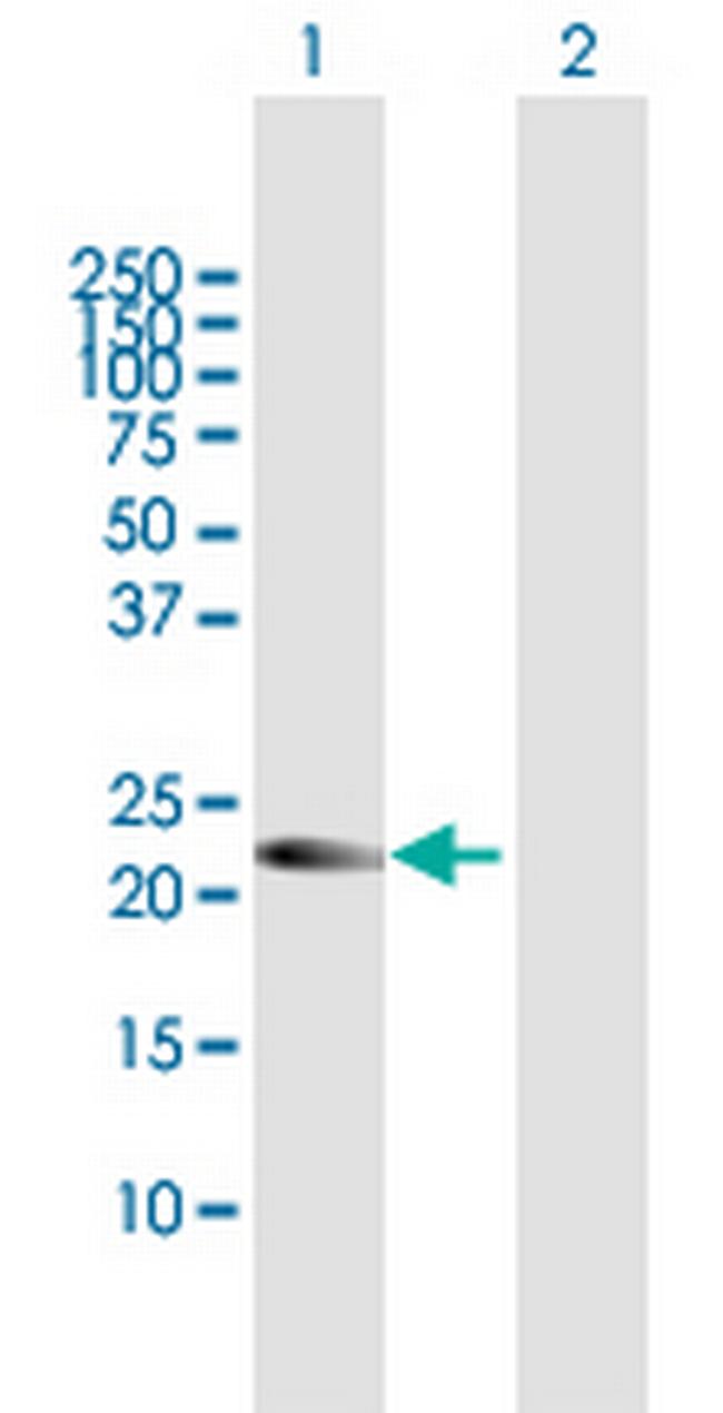 AMN1 Antibody in Western Blot (WB)