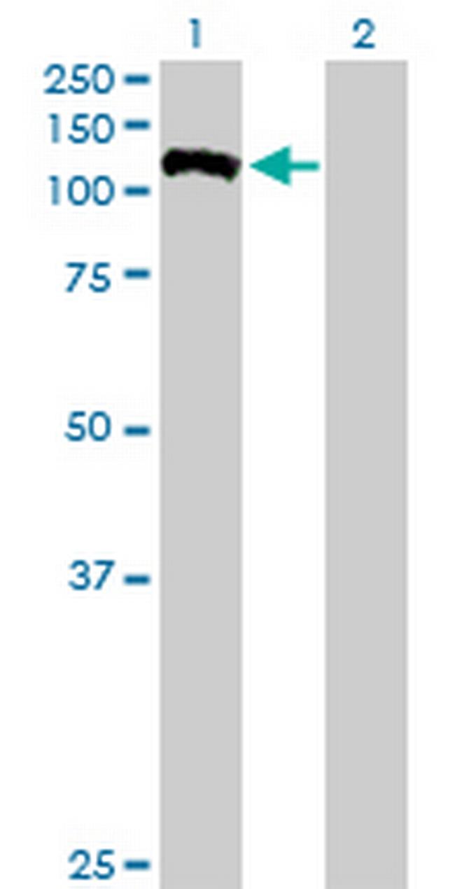 FUK Antibody in Western Blot (WB)