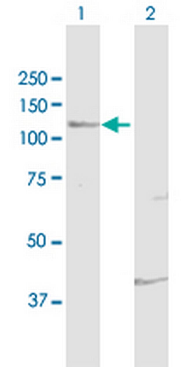 FUK Antibody in Western Blot (WB)