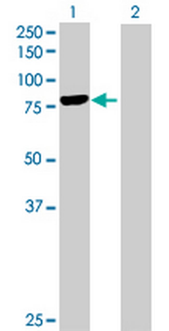 ZNF553 Antibody in Western Blot (WB)