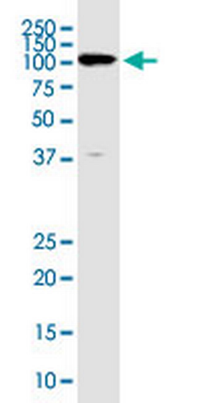 ZNF585A Antibody in Western Blot (WB)