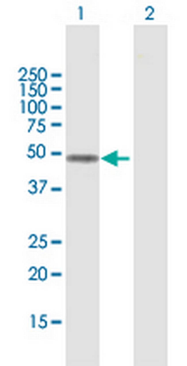 FOXD4L1 Antibody in Western Blot (WB)