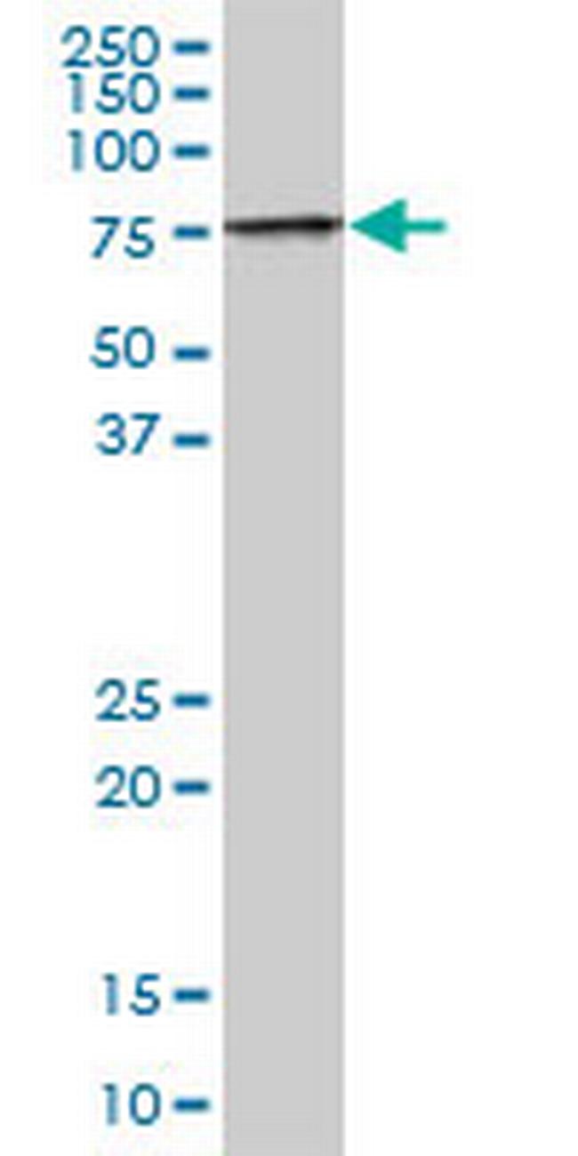 TIGD1 Antibody in Western Blot (WB)