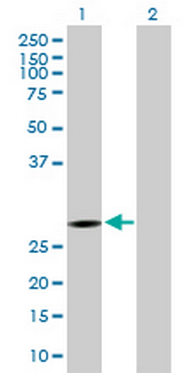KCTD6 Antibody in Western Blot (WB)