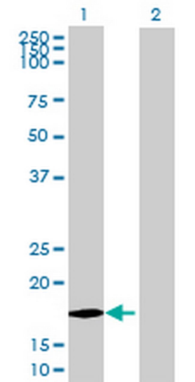 LOC201181 Antibody in Western Blot (WB)