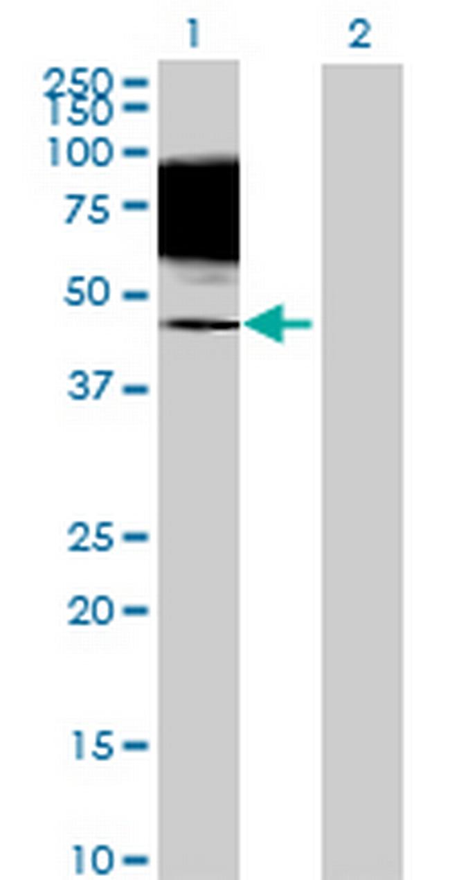 TIGD4 Antibody in Western Blot (WB)