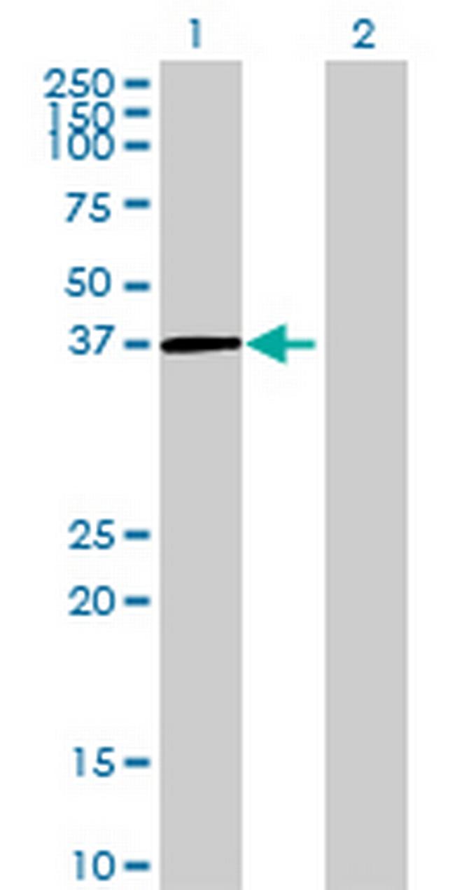 DNAJC18 Antibody in Western Blot (WB)