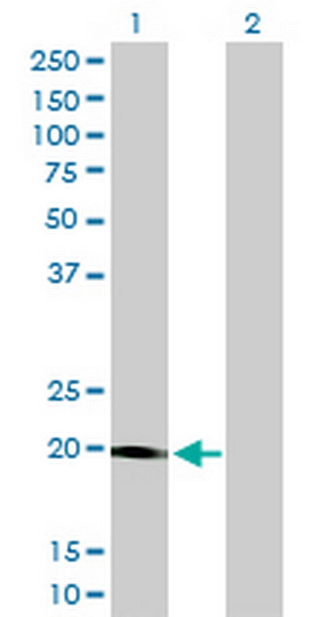 STK32A Antibody in Western Blot (WB)