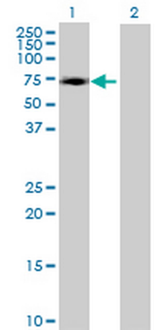 ZNF449 Antibody in Western Blot (WB)