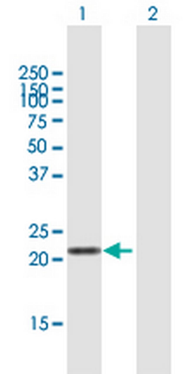 LVRN Antibody in Western Blot (WB)