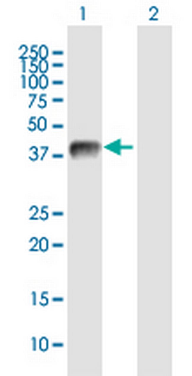 USP12 Antibody in Western Blot (WB)