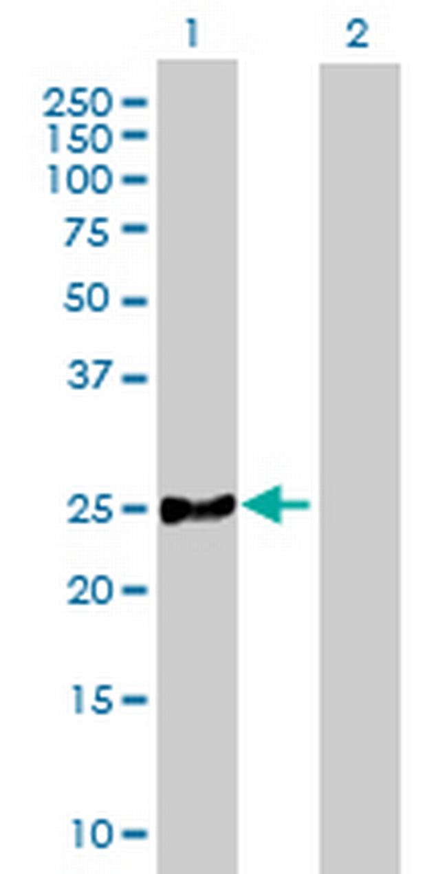 MRPL21 Antibody in Western Blot (WB)