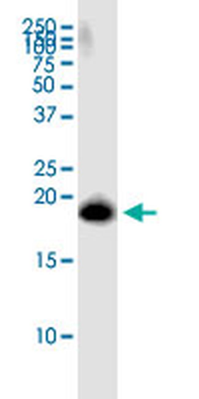 SPATA19 Antibody in Western Blot (WB)