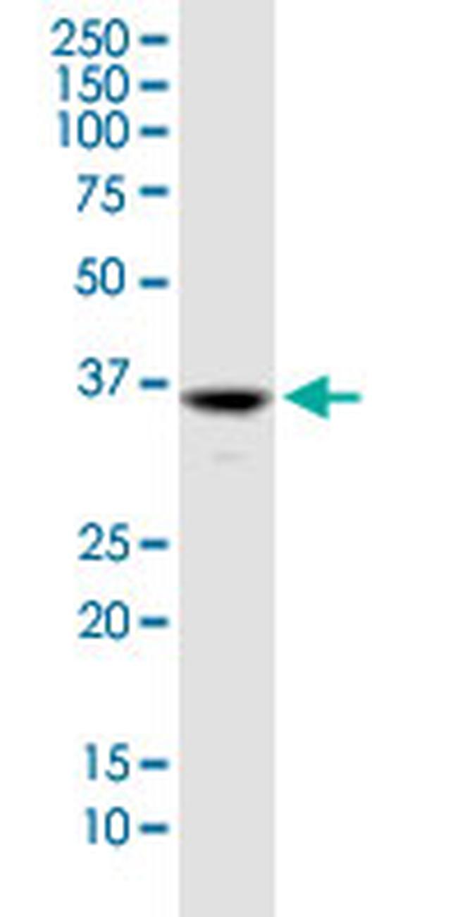 GLYATL2 Antibody in Western Blot (WB)