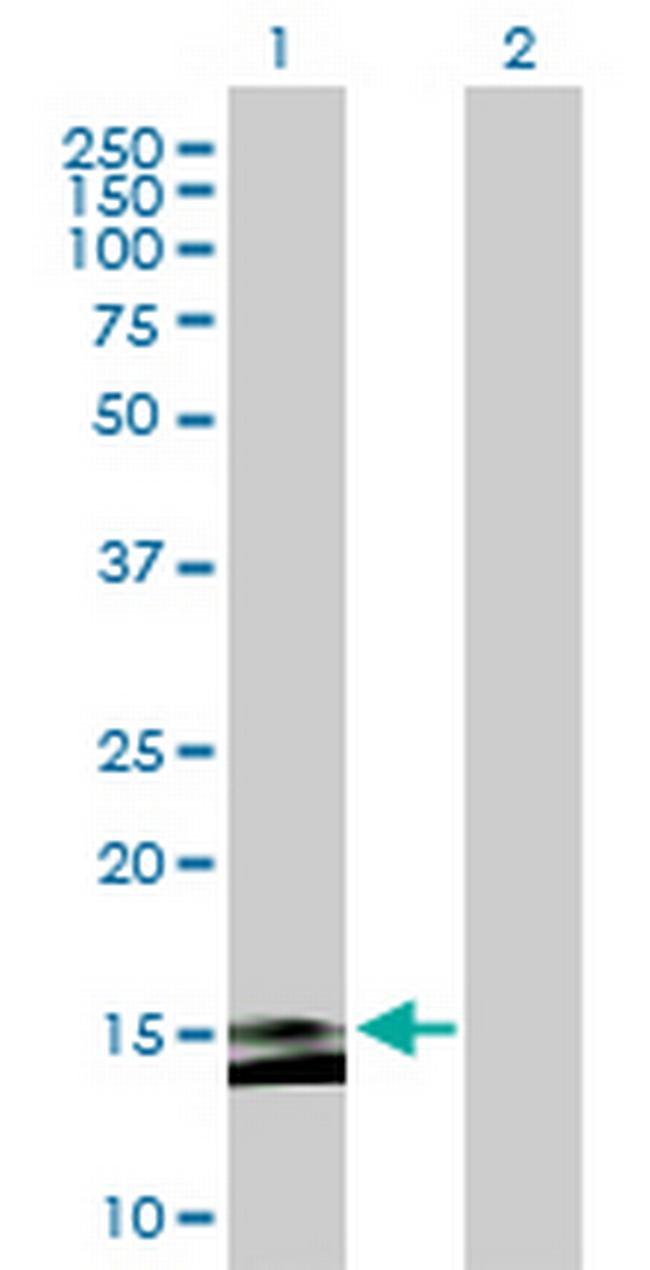 MS4A15 Antibody in Western Blot (WB)