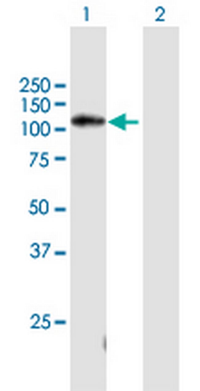 C11orf82 Antibody in Western Blot (WB)