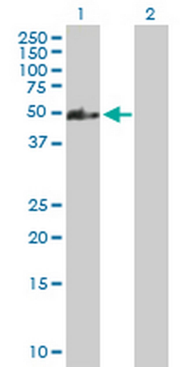 CCDC83 Antibody in Western Blot (WB)