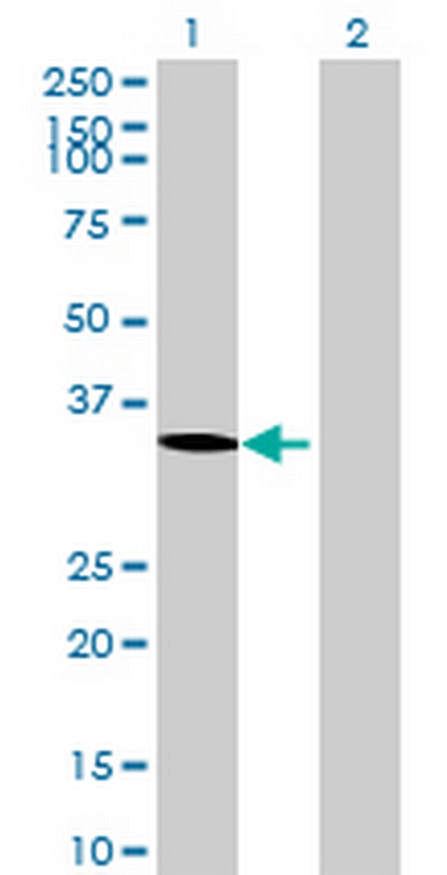 FLJ30707 Antibody in Western Blot (WB)