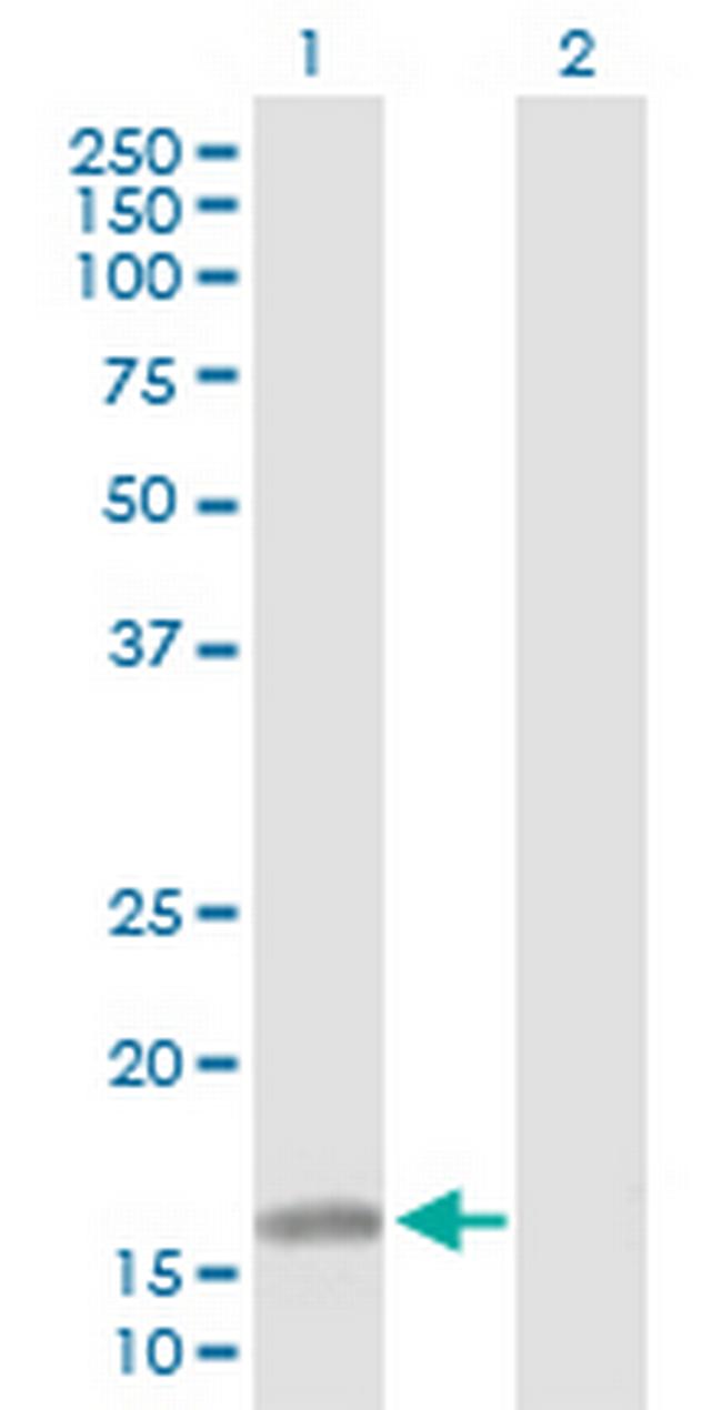 ATOH7 Antibody in Western Blot (WB)