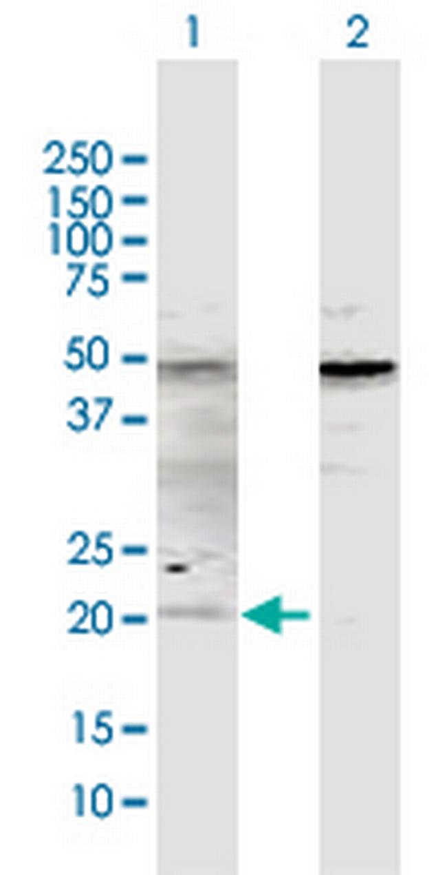 ATOH7 Antibody in Western Blot (WB)