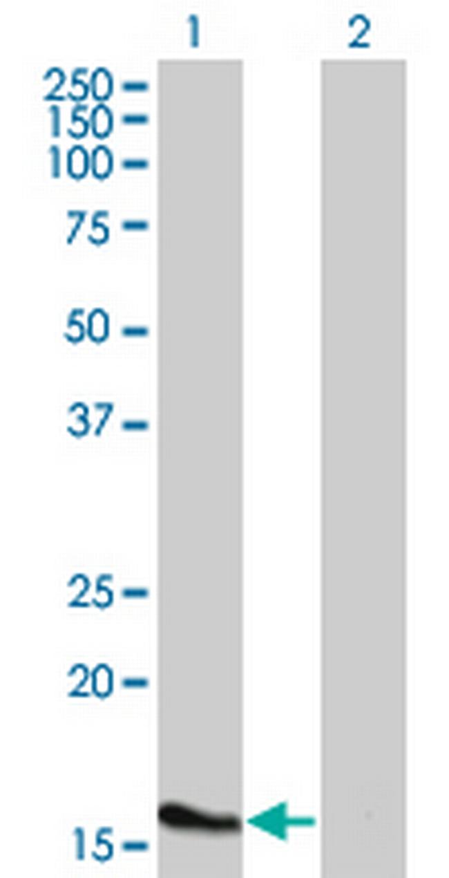 ATOH7 Antibody in Western Blot (WB)
