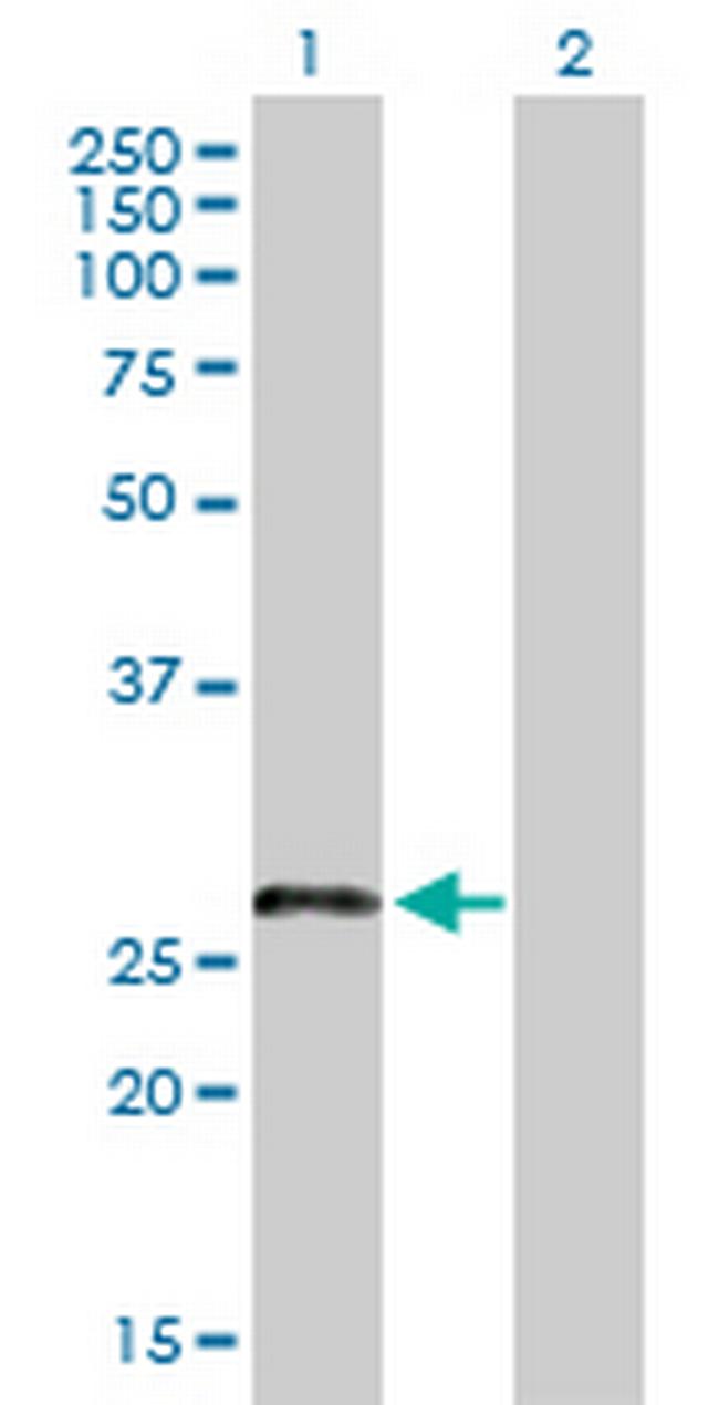 LOC221091 Antibody in Western Blot (WB)