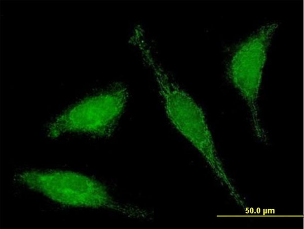 C6ORF206 Antibody in Immunocytochemistry (ICC/IF)