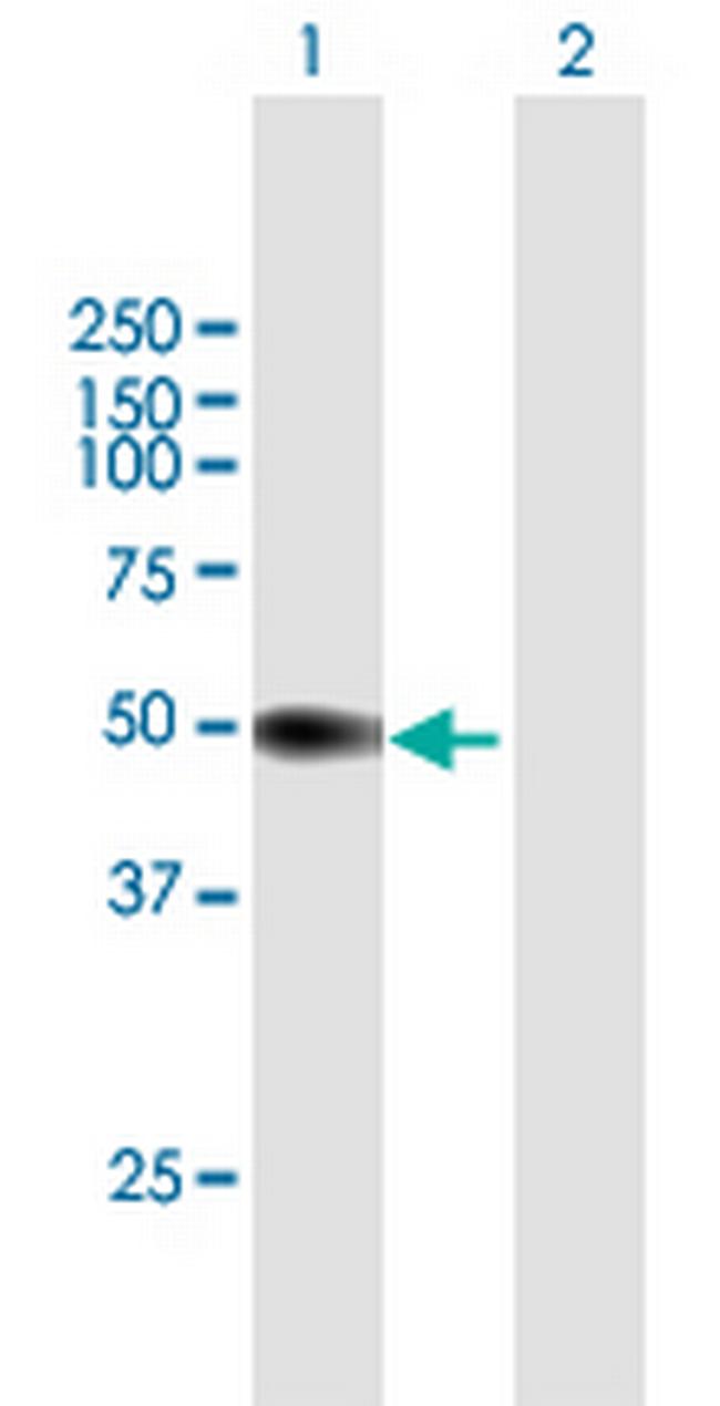 PI16 Antibody in Western Blot (WB)