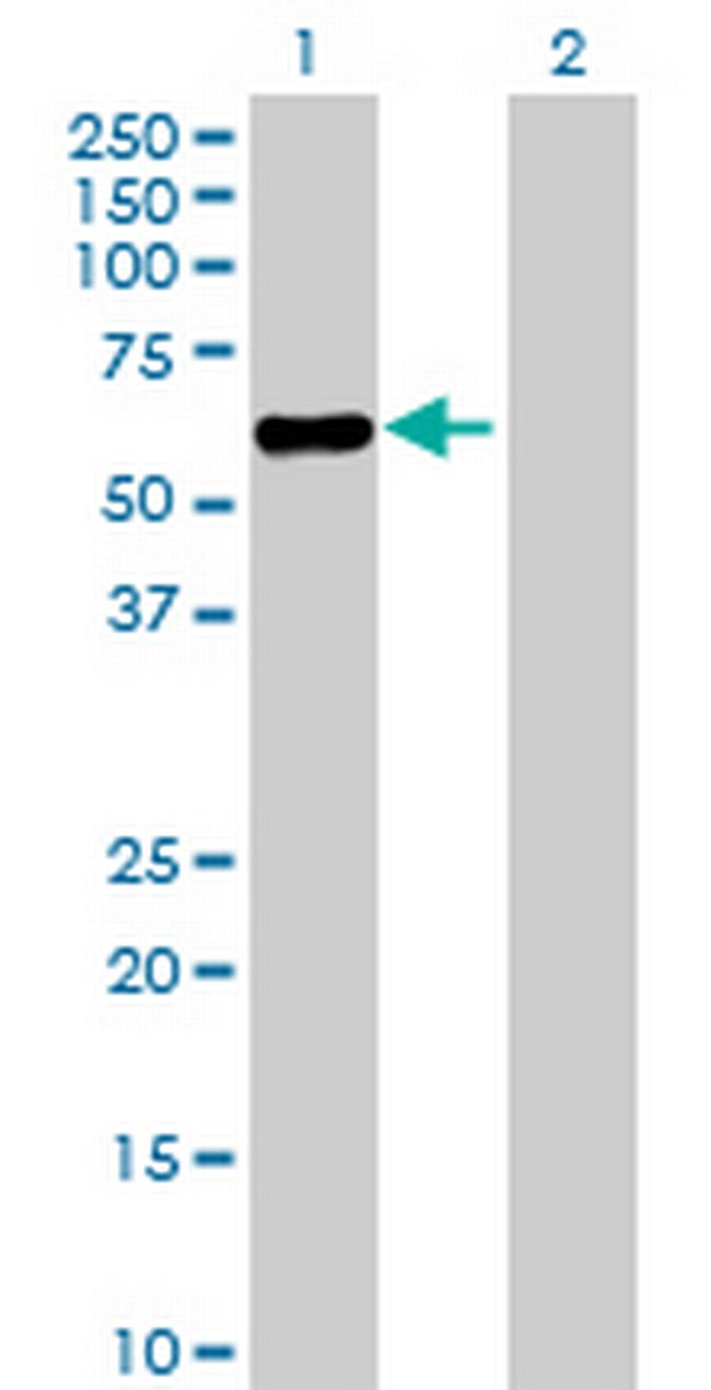 ZNF498 Antibody in Western Blot (WB)