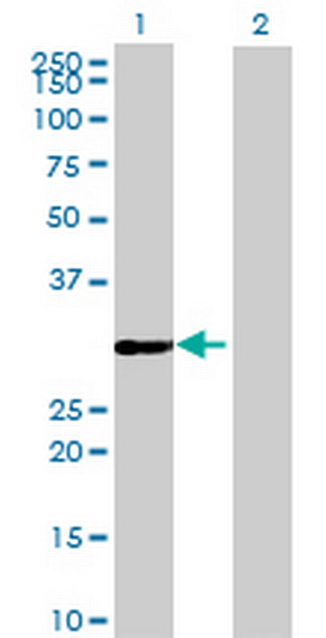LOC222701 Antibody in Western Blot (WB)
