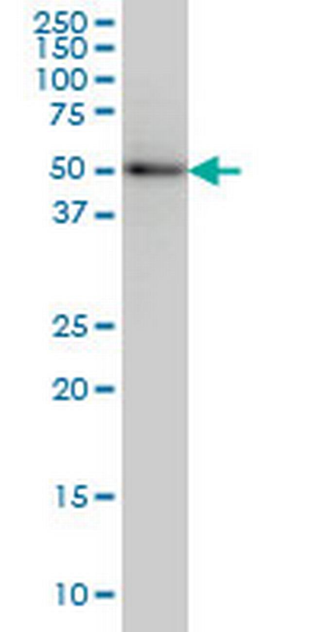 SLC29A4 Antibody in Western Blot (WB)