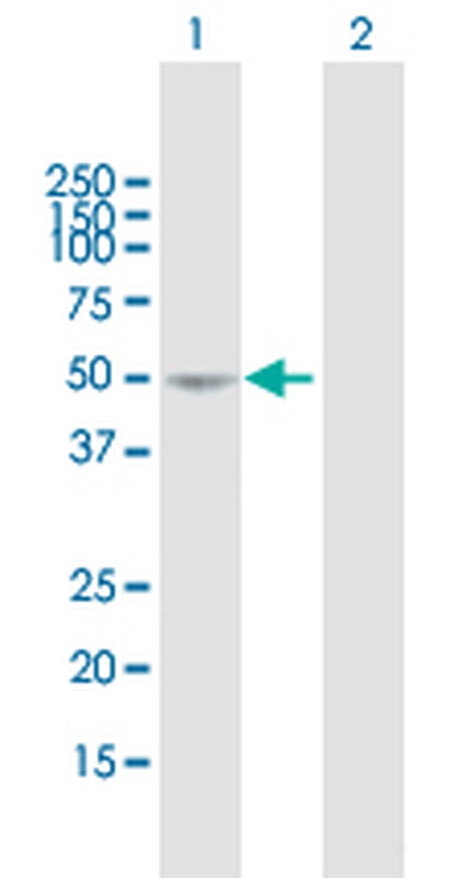 SEMA3D Antibody in Western Blot (WB)