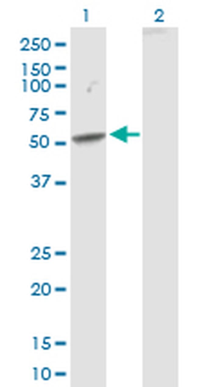 SEMA3D Antibody in Western Blot (WB)