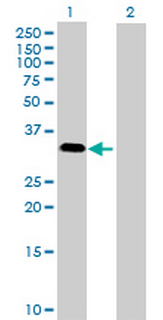 MAPK15 Antibody in Western Blot (WB)