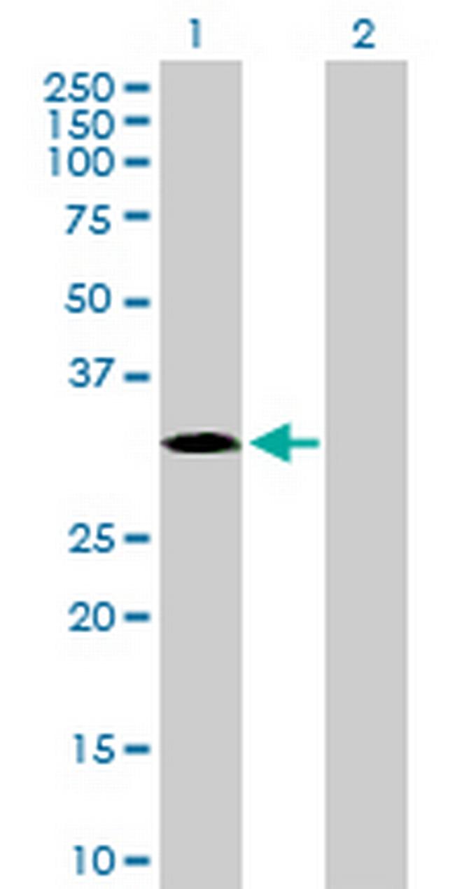 MAPK15 Antibody in Western Blot (WB)
