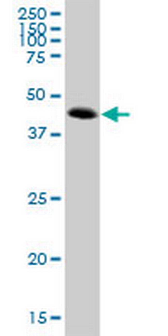 ATP6V1C2 Antibody in Western Blot (WB)