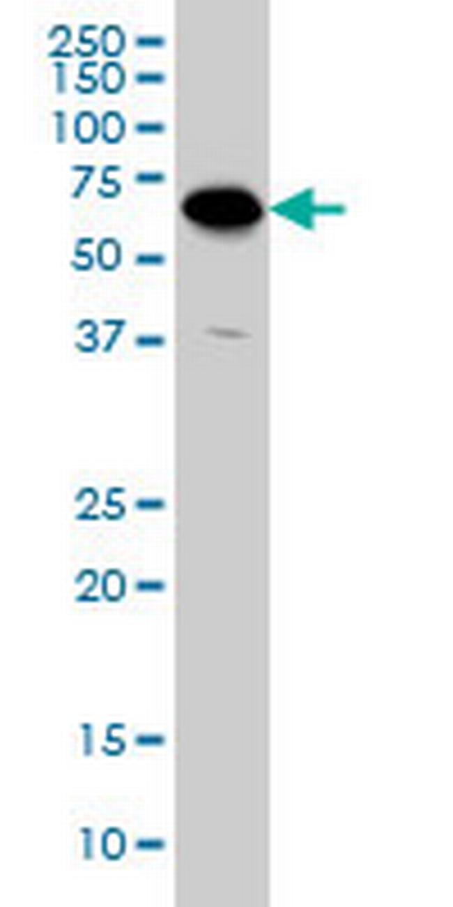 ATP6V1C2 Antibody in Western Blot (WB)