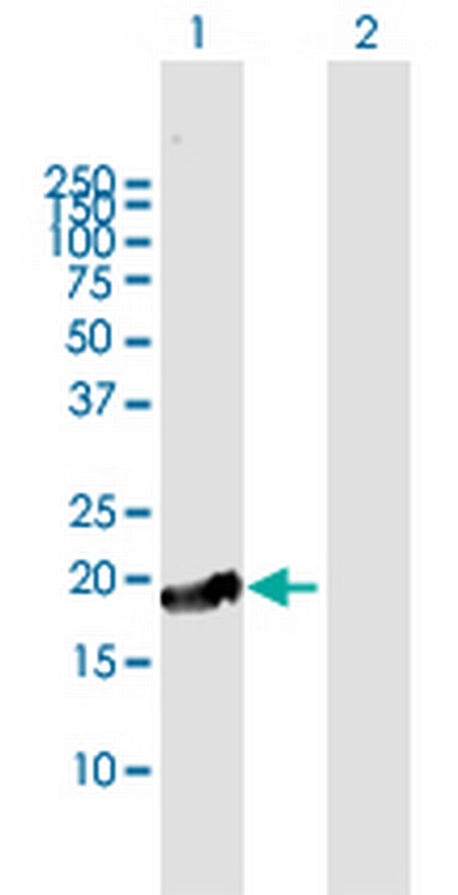 CTAG1A Antibody in Western Blot (WB)