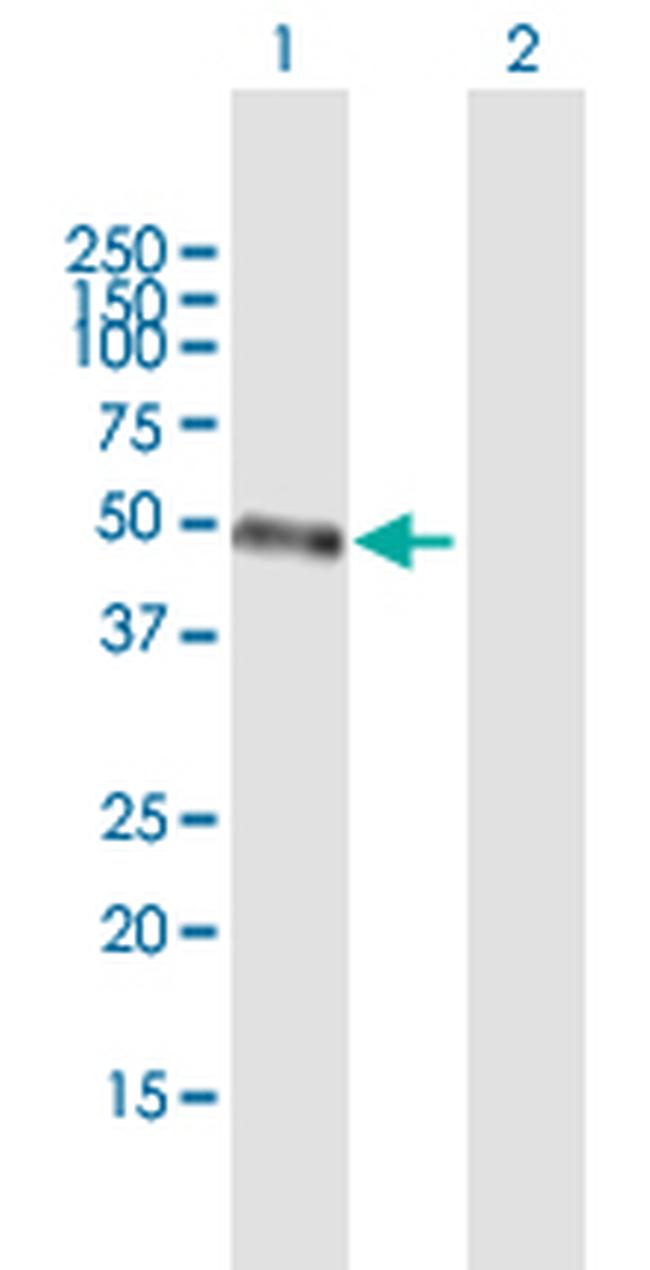 STAC3 Antibody in Western Blot (WB)