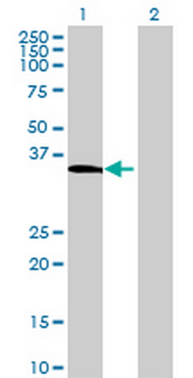 PELI3 Antibody in Western Blot (WB)