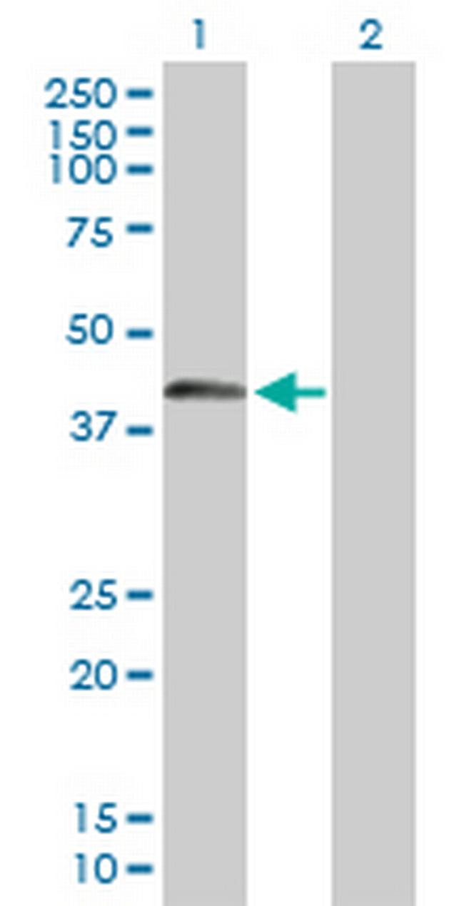 SPESP1 Antibody in Western Blot (WB)