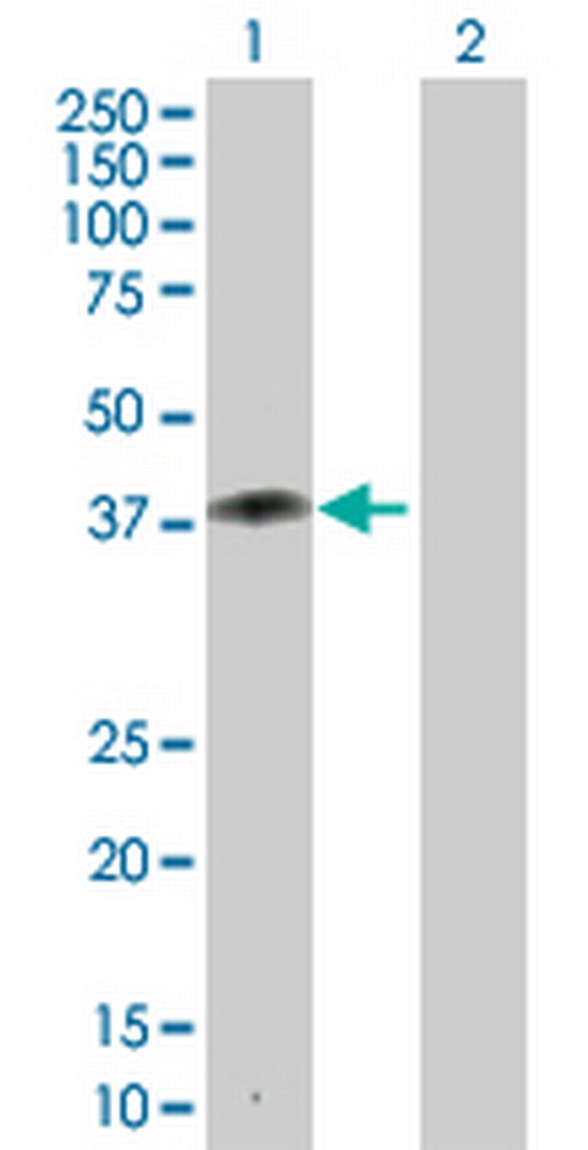 ZNF396 Antibody in Western Blot (WB)