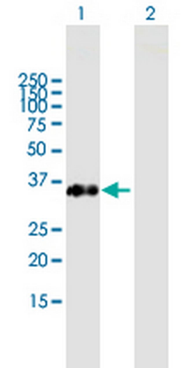 FAM21C Antibody in Western Blot (WB)